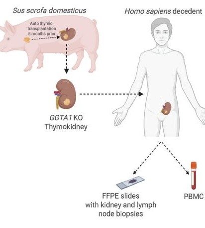 Schematic of a pig thymokidney transplanted into a human decedent
