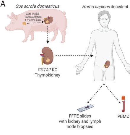 Schematic of a pig thymokidney transplanted into a human decedent, with biopsies and blood sampling